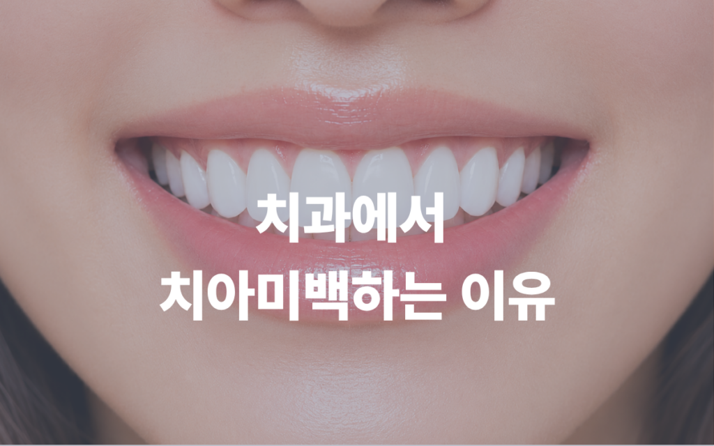 치아미백 제품이 많은데도 사람들이 치과를 찾는 이유