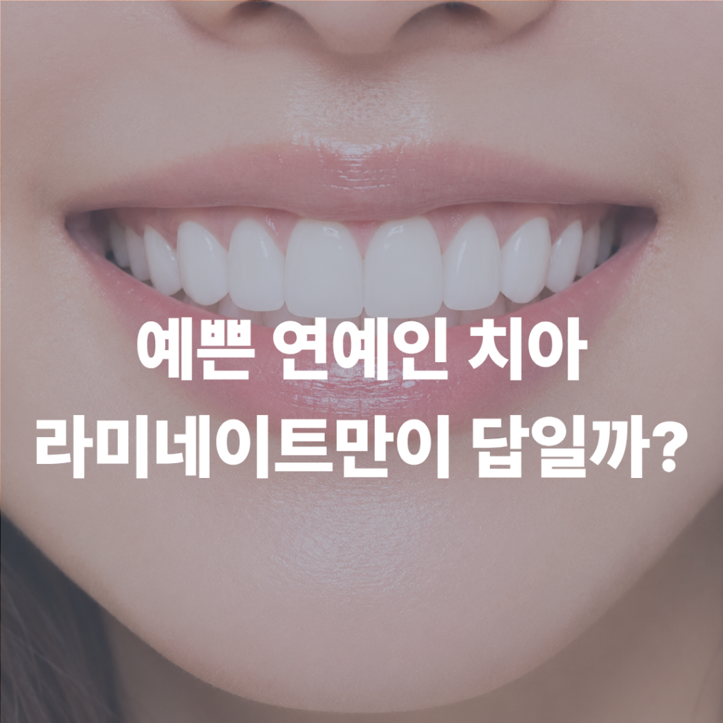 연예인 치아가 예쁜 진짜 이유, 라미네이트만은 아닙니다
