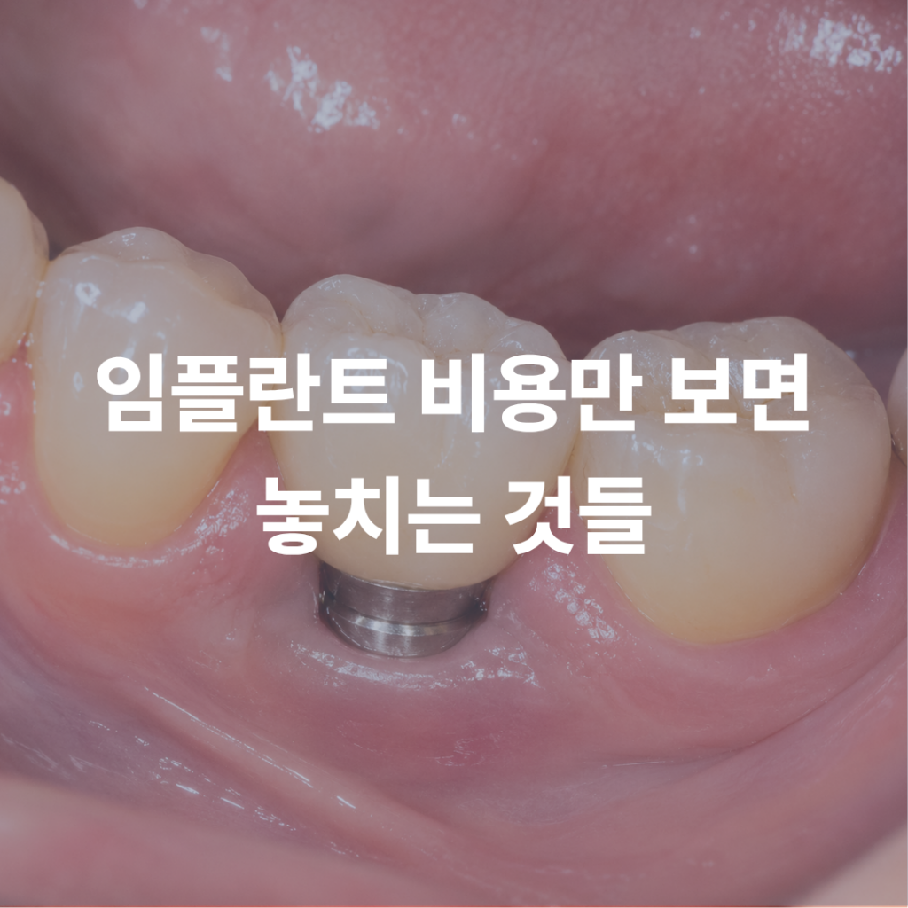임플란트 비용만 비교하면 놓치는 것들, 꼭 확인하세요