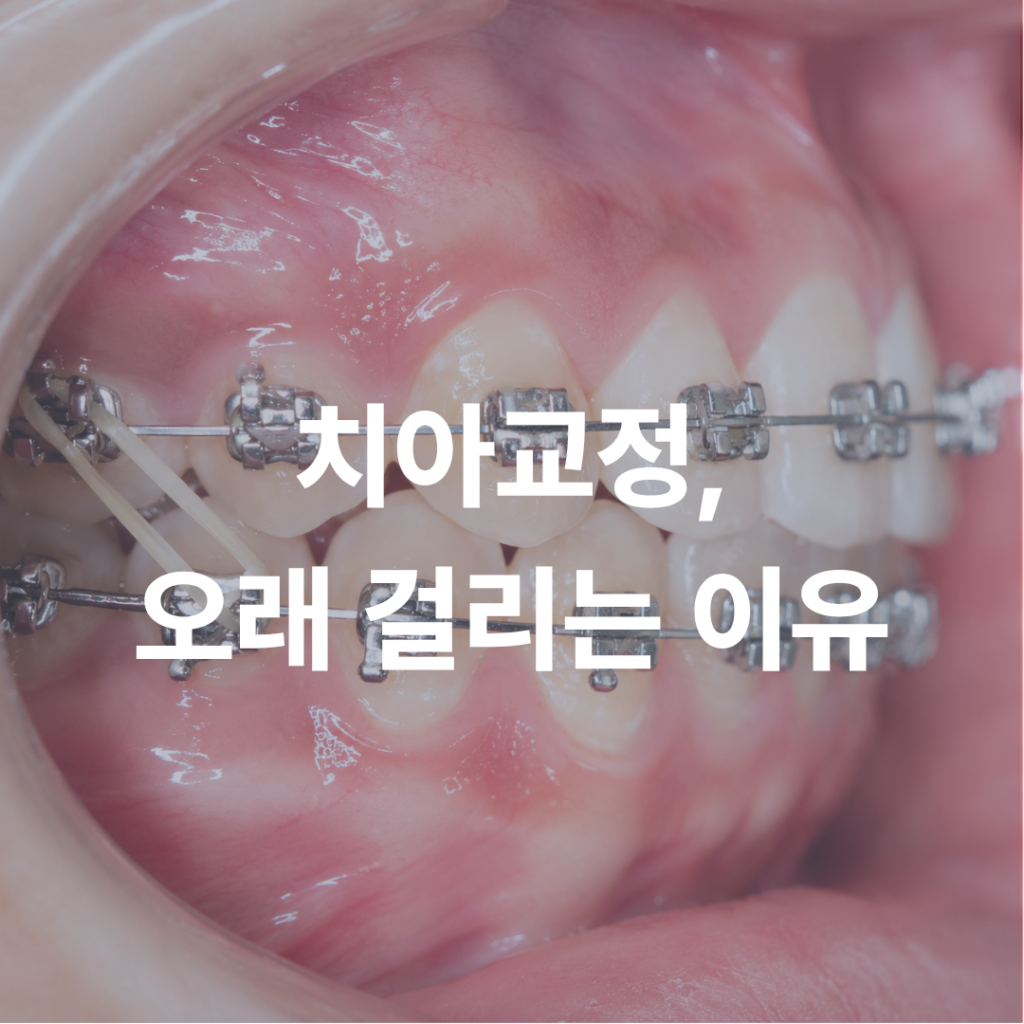 치아교정, 오래 걸리는 이유