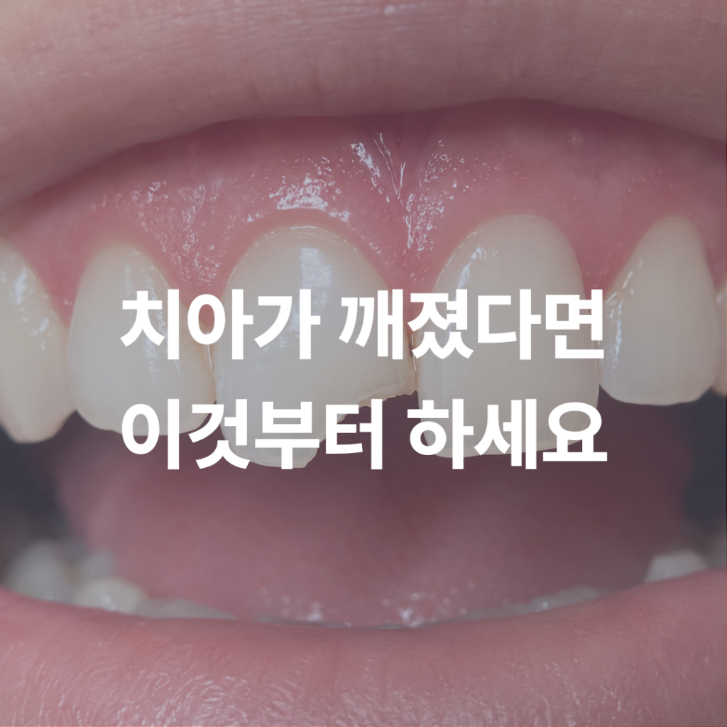 깨진 치아, 방치하면 위험! 치과 방문 전 응급 대처법 | 도곡동치과