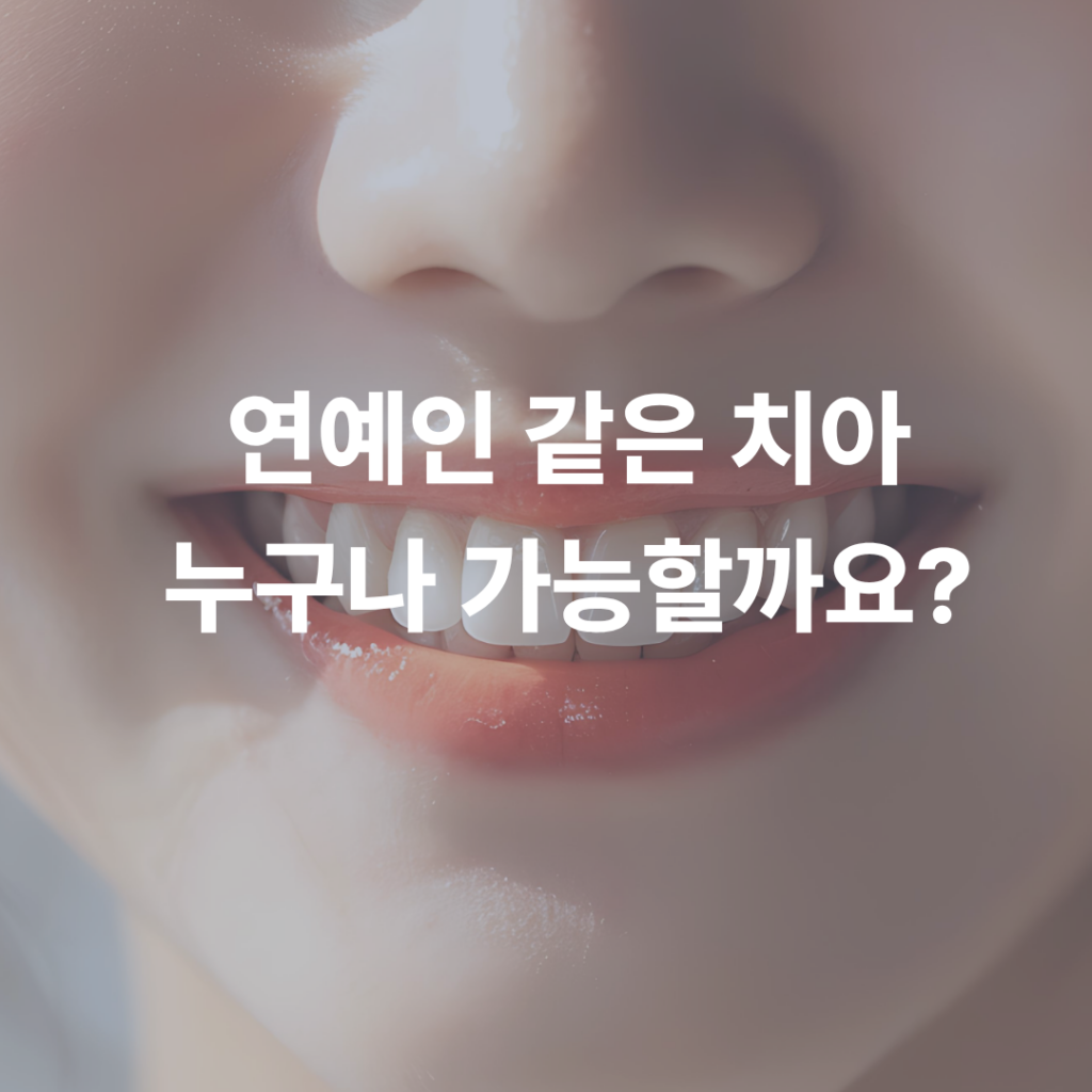 연예인처럼 웃고 싶다면 내 치아부터 살펴보세요