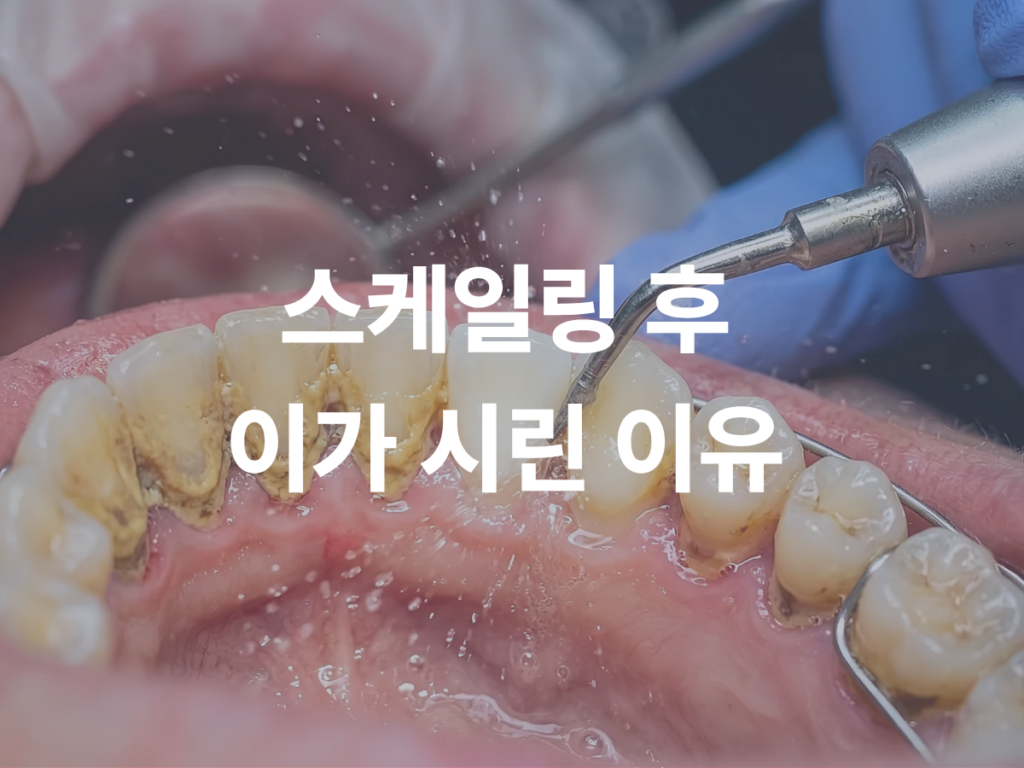 스케일링 후 치아 시림, 치료 부작용일까요? 원인부터 알아보세요